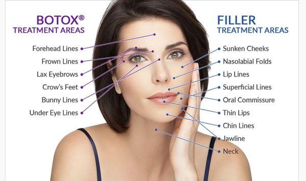 Differences between Relaxers and Fillers.