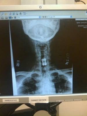 My xray :-)