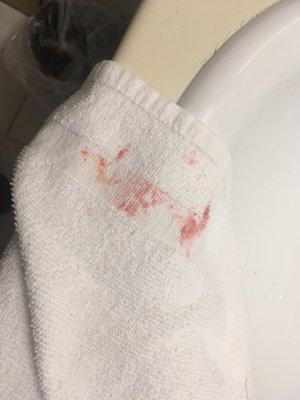 Filthy towel with stains