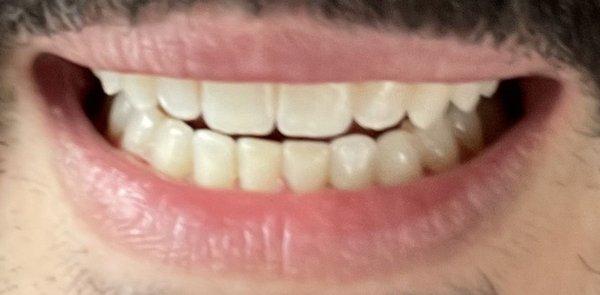 Perfect Smile by Dr. Wise