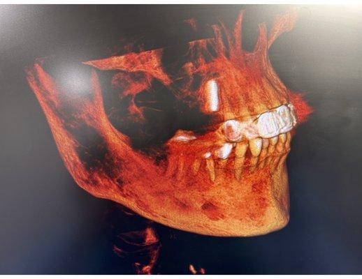 3-D scan for your jaws