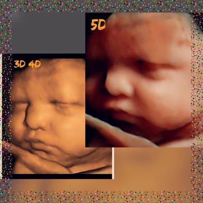 It's the new 5D, on how your baby looks just like in the womb. Only a GE trademark.