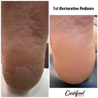 Restorative Pedicure