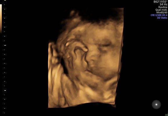 One of my ultrasounds at around 28 weeks. Love the technology in her office and how it is not outdated like other places.