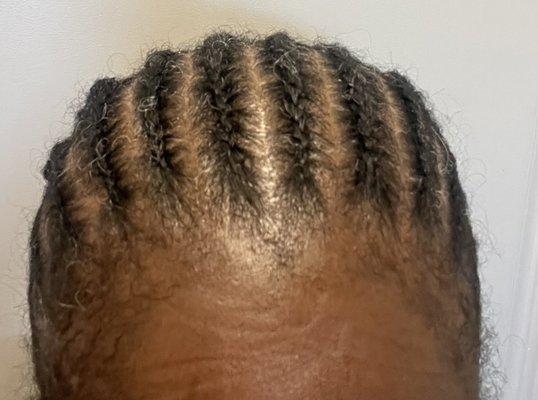 Front of my GuyJo Braids