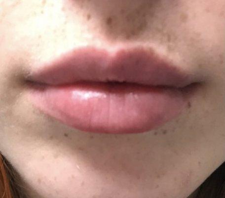 Beautiful lips by Paula RN