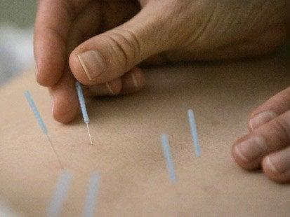 Acupuncture & Traditional Chinese Medicine