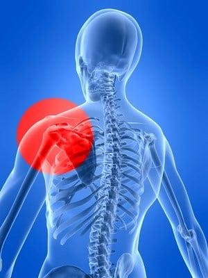 Shoulder pain