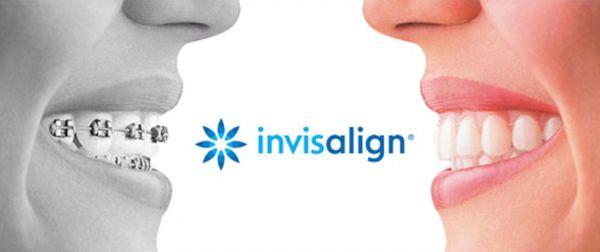 Invisalign