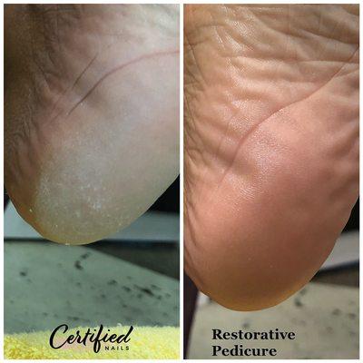 Restorative Pedicure