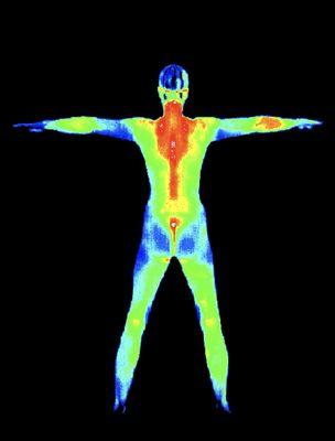 Advantage Scan Thermography