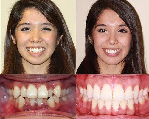 Sarah's beautiful transformation case.