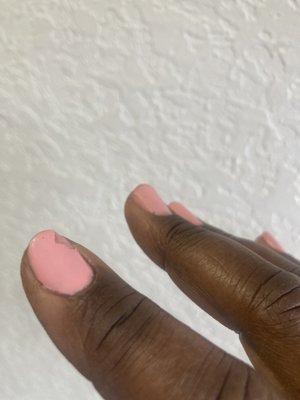 Lumpy, poorly polished nails that are chipping.