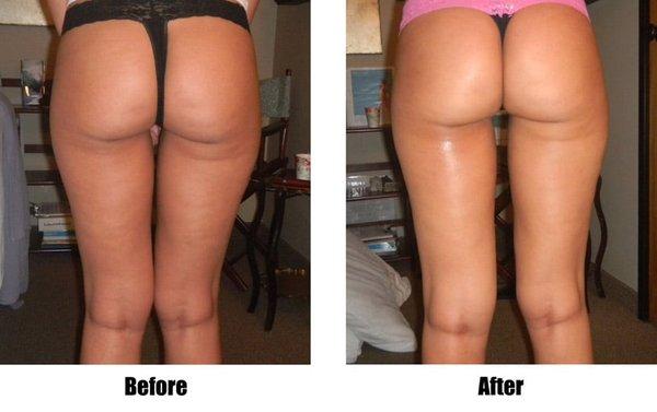 10 treatments of microcurrent body sculpting 2x per week