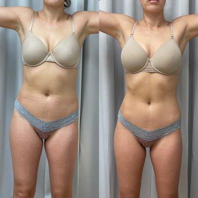 5 Sessions of Bodi-Current Treatments