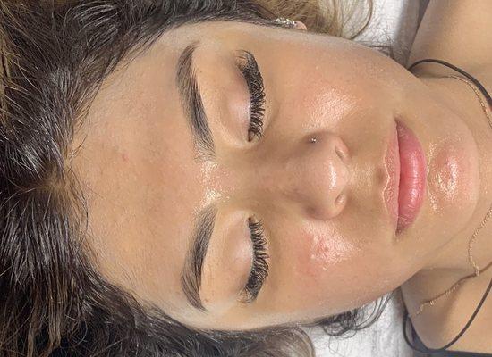 Enzyme oxygen facial