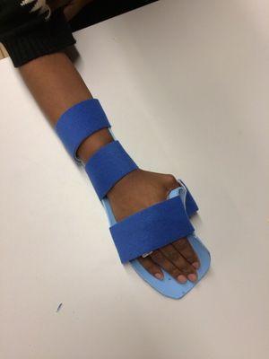 Splint Fabrication and Orthotic intervention