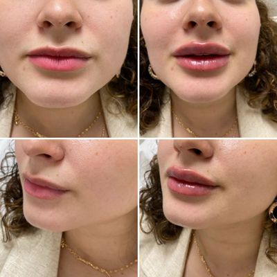 Beautiful lips by Anna