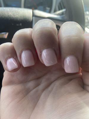 Extremely crooked and lumpy nails