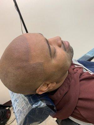 This client was suffering from thinning hair and a receding hairline. SMP gave him instant results.