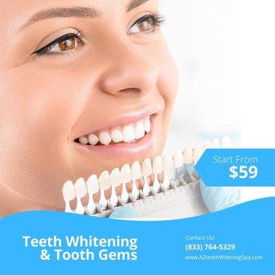 We shade your teeth so you can easily notice the change!