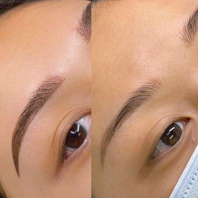 Before and after brow correction