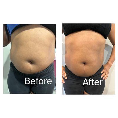 40k Cavitation