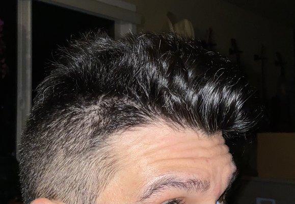 From the side- there is a patch where hair shouldn't have even been cut.