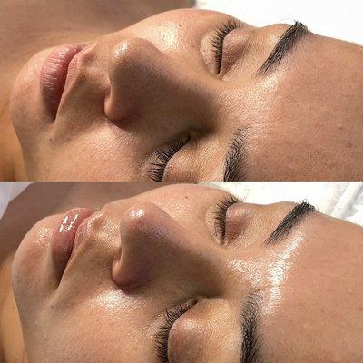 60 minute customized facial with added dermaplane