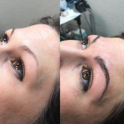 Such a difference!  Before and after Microblading on brows.