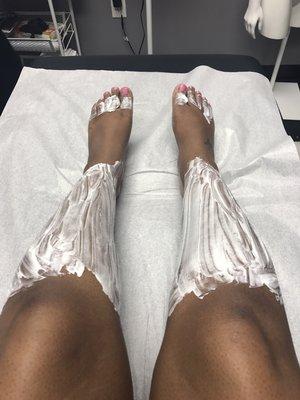 Legs during Painless hair removal service