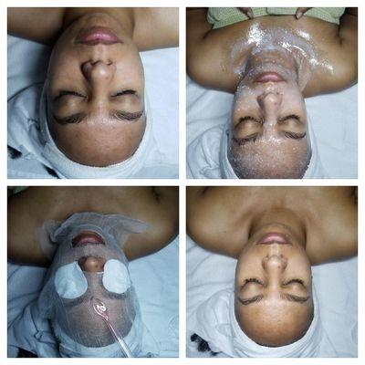 Vitamin C Facial