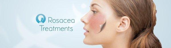 Rocesea Treatment