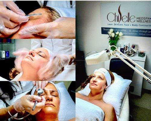 Reveal, enhance & rejuvenate your Natural beauty @chiselleaesthetics