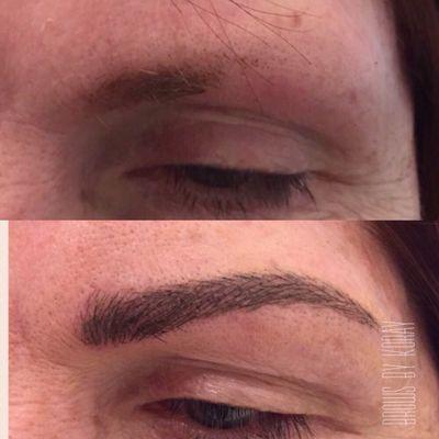 Missing eyebrows corrected with 3D/Microblading