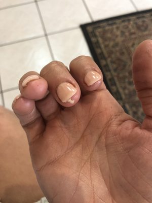 Glue coming from under nails