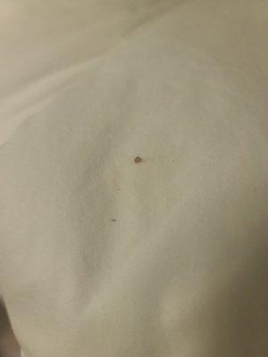 Blood stain on bed sheet