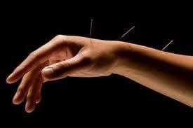 Acupuncture on the hand & wrist