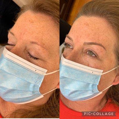 Microblading