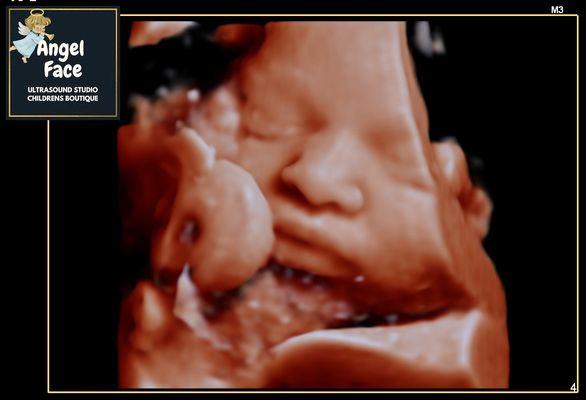 3D/4D/5D/HD baby imaging studio located in Greensboro, NC!