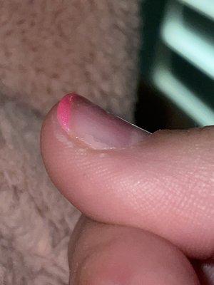 you can see the small chipping on my thumb