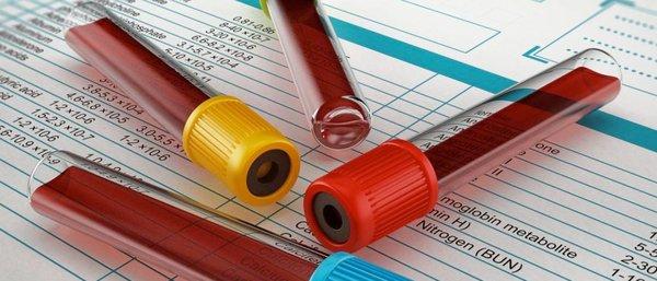 Blood chemistry analysis. Determine if your headaches, muscle or joint pain are related to inflammation, nutrient need or metabolic issues.