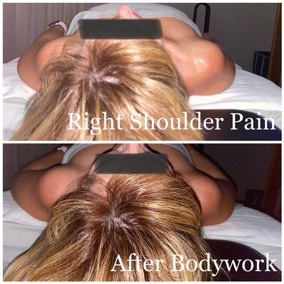 Shoulder pain