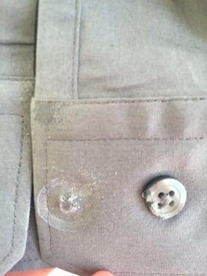 Damage to a brand new shirt, one button pulverized, the second damaged.