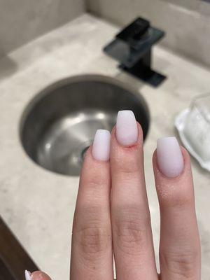 Cuts across cuticle on three fingers