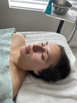 O2 Facial