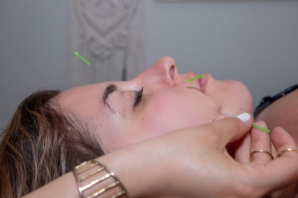 Facial rejuvenation treatment