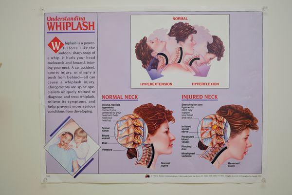 Whiplash injury: Before vs. After