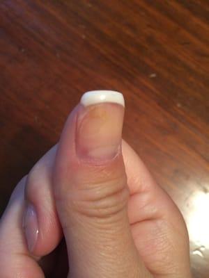 This was the "fix" job after I saw mold under my nail.