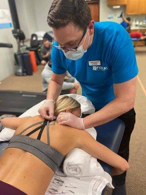 Dry needling is a technique used by PTs to eliminate muscle pain. Using a sterile filiform needle in muscle to release trigger points.